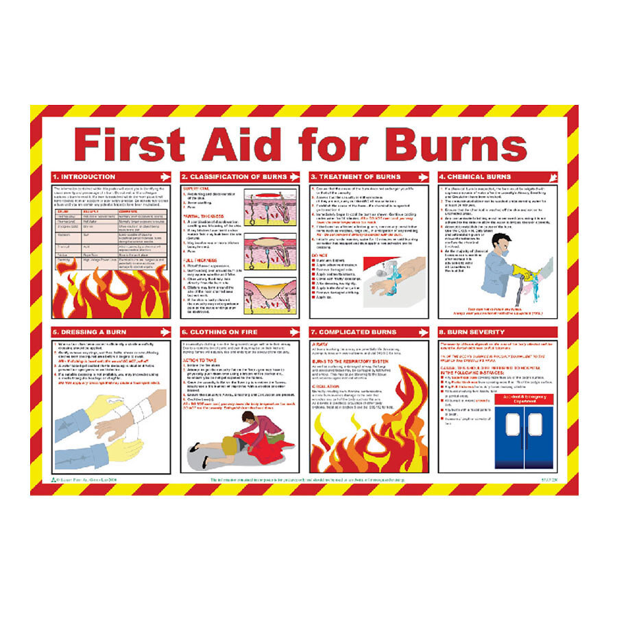Mileta First Aid For Burns Poster Encapsulated 42x59cm